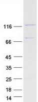 Human SCP1 / SYCP1 Protein (Recombinant Myc-DDK (Flag))
