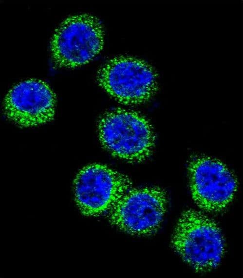 IHC-plus™ Polyclonal Rabbit anti-Human FASN / Fatty Acid Synthase Antibody (aa942-973, IHC, IF, WB)