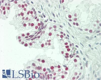 IHC-plus™ CCAR2 / KIAA1967 Antibody (aa1-50)