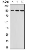 Polyclonal Rabbit anti-Human EPH Receptor B1+B2 Antibody (Internal, IHC, IF, WB)