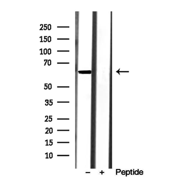 AHCYL1 / DCAL Antibody