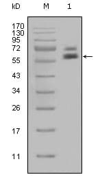 IHC-plus™ KRT5 / CK5 / Cytokeratin 5 Antibody (clone 10)