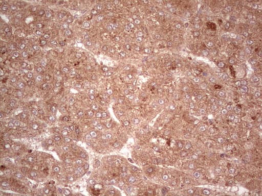 UBE2D2 / UBCH5B Antibody (clone OTI2C2)