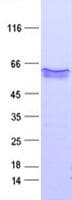 Human VWF / Von Willebrand Factor Protein (Recombinant DDK,C-terminus)