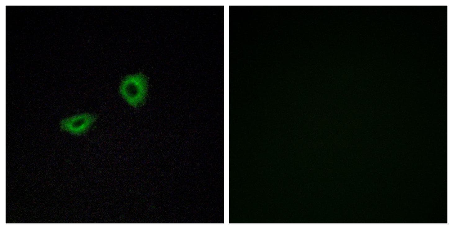CHRM5 / M5 Antibody