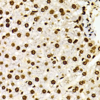 Histone H3 Antibody (Dimethyl-Lys27)