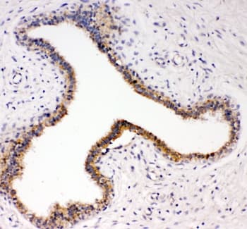 NTRK3 / TRKC Antibody (aa167-182)