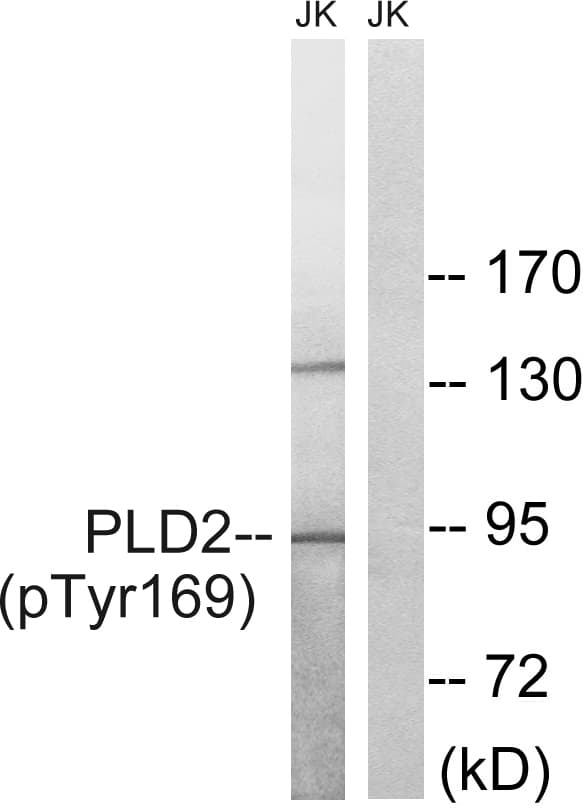 PLD2 / Phospholipase D2 Antibody (phospho-Tyr169)