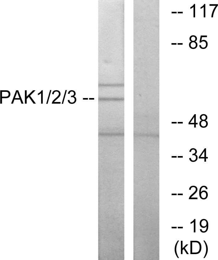 IHC-plus™ Polyclonal Rabbit anti-Human PAK1 + PAK2 + PAK3 Antibody (aa391-440, IHC, WB)