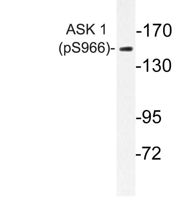 Polyclonal Rabbit anti-Human MAP3K5 / ASK1 Antibody (phospho-Ser966, IHC, WB)
