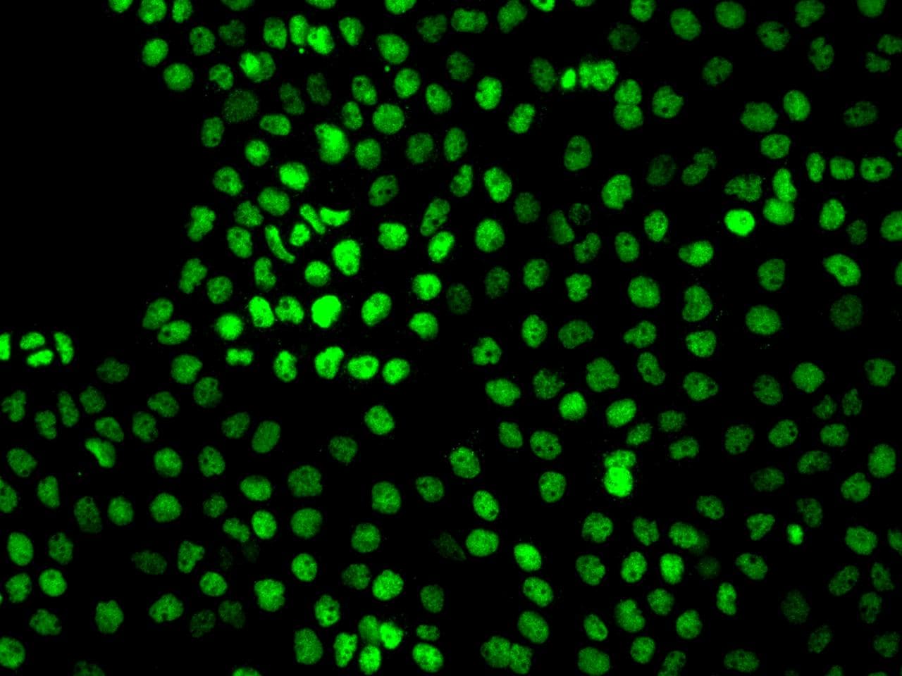 Polyclonal Rabbit anti-Human VSIR / GI24 / VISTA Antibody (IF)