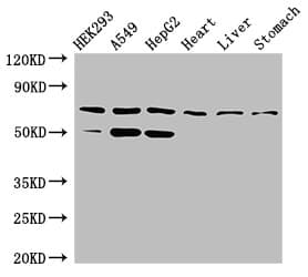 TCTN3 Antibody