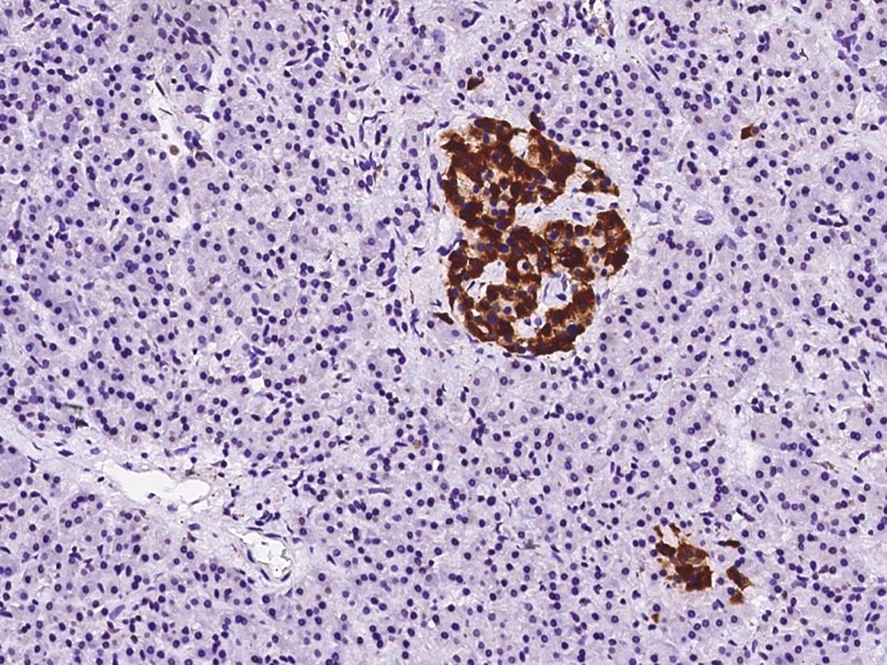 Polyclonal Rabbit anti-Human PTPRN / IA-2 Antibody (IHC, WB)