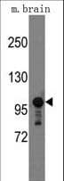 SEMA5A / Semaphorin 5A Antibody (aa1006-1035)