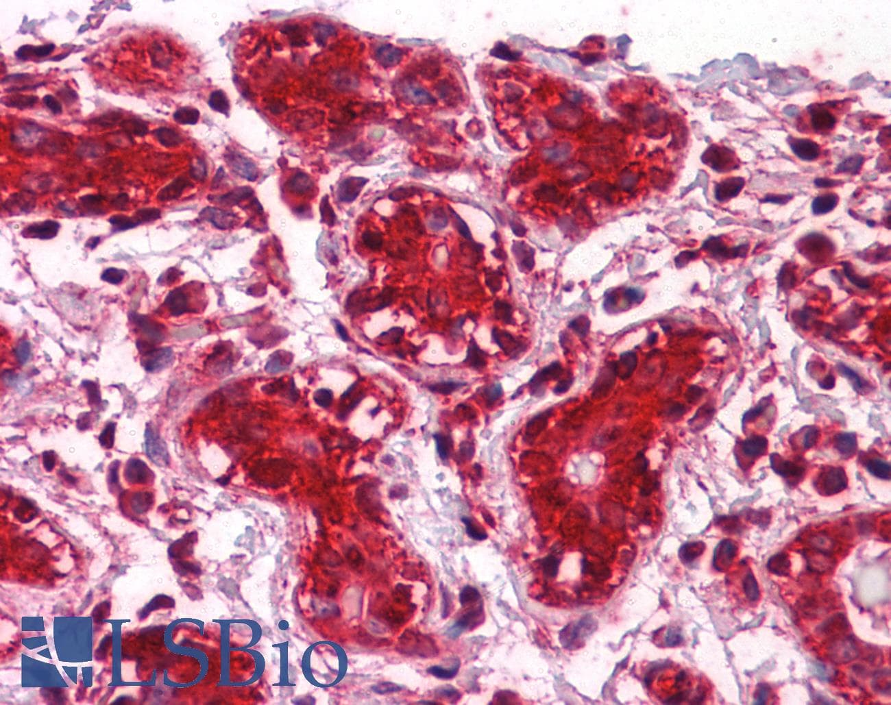 IHC-plus™ CLIC1 / NCC27 Antibody (clone 2D4)