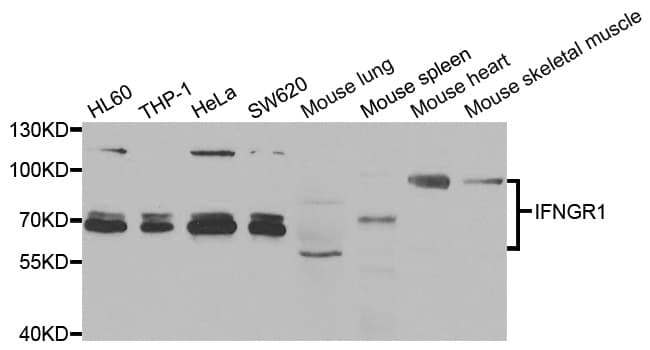 Polyclonal Rabbit anti-Human CD119 / IFNGR1 Antibody (IHC, WB)