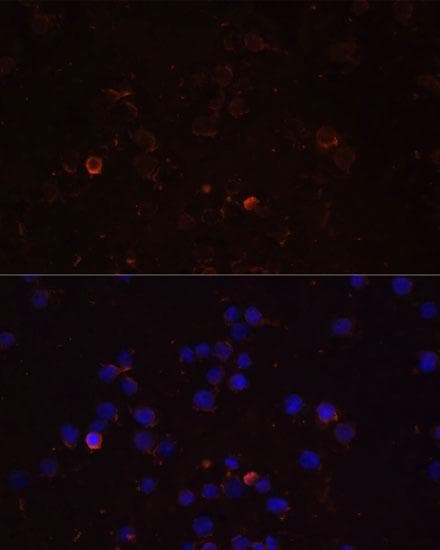 TLR4 Antibody