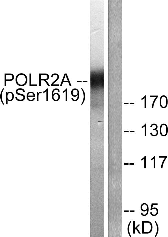 POLR2A / RNA polymerase II Antibody (phospho-Ser1619)