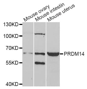 Polyclonal Rabbit anti-Human PRDM14 Antibody (WB)