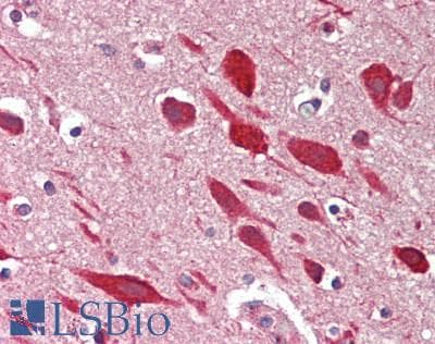 Polyclonal Rabbit anti-Human KALRN / KALIRIN Antibody (Internal, IHC, IF, WB)
