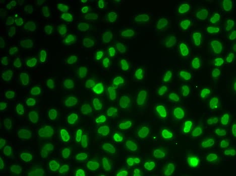 Polyclonal Rabbit anti-Human NONO / P54NRB Antibody (IHC, IF, WB)