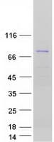 Human HINFP Protein (Recombinant Myc-DDK (Flag))