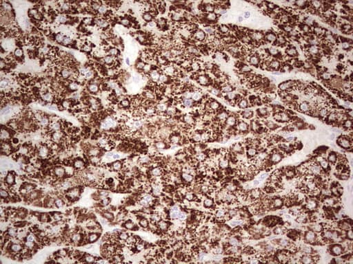 ABAT Antibody (aa29-323, clone OTI7E9)