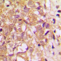 TIMP2 Antibody (Internal)