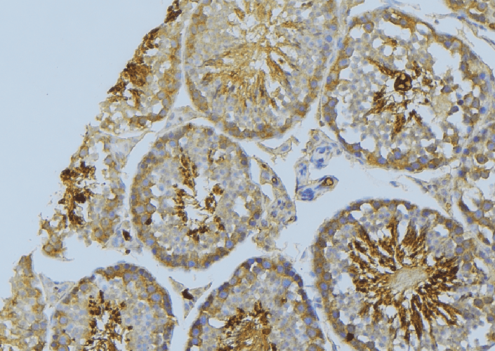 BAD Antibody