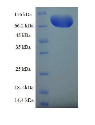 Human GNL3L Protein (Recombinant His-SUMO)