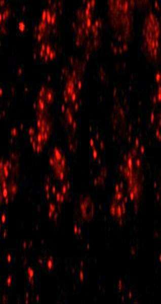 IHC-plus™ PHF6 Antibody (aa125-175)