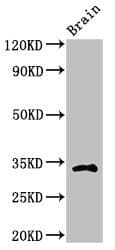 CASP6 / Caspase 6 Antibody
