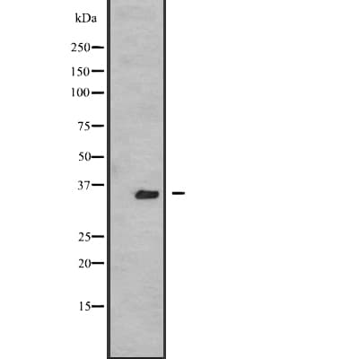 Polyclonal Rabbit anti-Human TSSK3 / STK22C Antibody (WB)