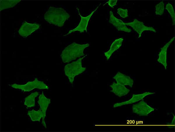 DPYD / DPD Antibody (clone 7D4)