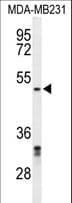 Polyclonal Rabbit anti-Human CBX2 Antibody (aa47-75, WB)