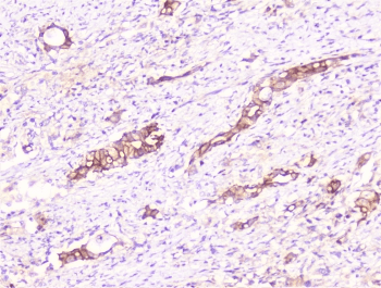 COMP / THBS5 Antibody