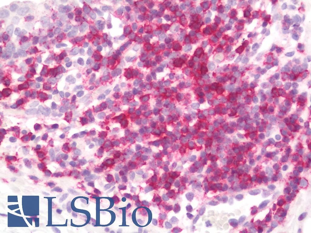 PathPlus™ CD6 Antibody (clone UMCD6/3F7B5, Azide-free)
