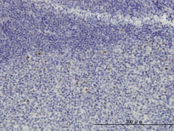 NOP16 Antibody (clone 1G4)