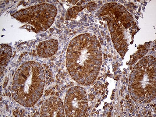 HDHD3 Antibody (clone OTI1C5, Carrier-free)