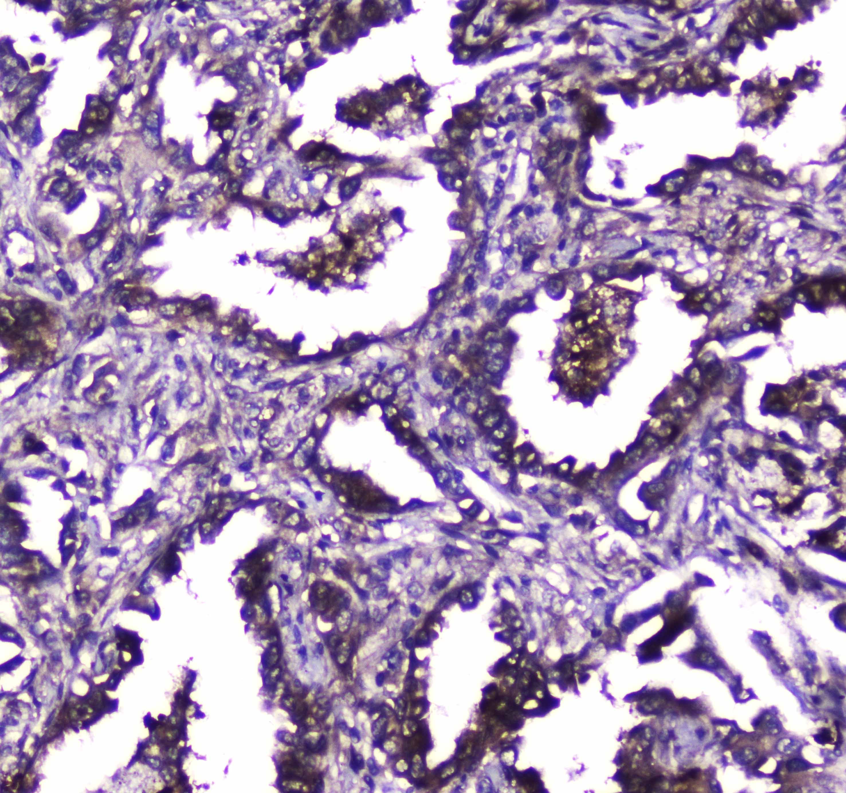 TLR1 Antibody