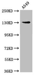 AMOT / Angiomotin Antibody (aa1-300)