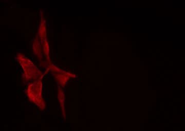 PSMD11 Antibody