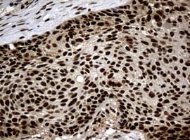 PCNA Antibody (clone OTI6A10)