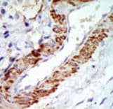 MAP3K8 / TPL2 Antibody (aa414-445)