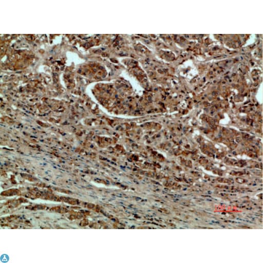 Polyclonal Rabbit anti-Human DCT / Dopachrome Tautomerase Antibody (WB)
