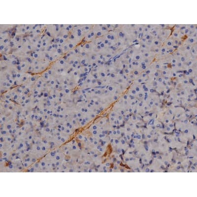 STAT6 Antibody (phospho-Tyr641)