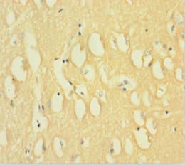 DNM1 / Dynamin Antibody (aa2-245)