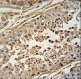 FBXO24 Antibody (aa118-145)