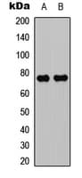 Polyclonal Rabbit anti-Human PRKCQ / PKC-Theta Antibody (C-Terminus, IHC, WB)