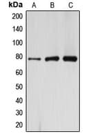 Polyclonal Rabbit anti-Human ARHGAP22 / RhoGAP2 Antibody (C-Terminus, IHC, WB)